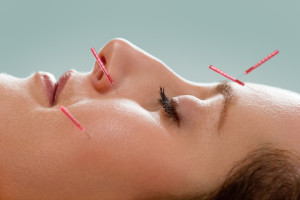 Person receiving acupuncture