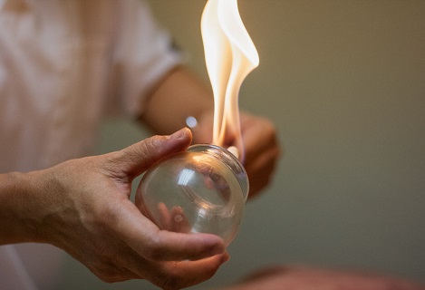 Image shows a practitioner applying fire inside of a glass cup