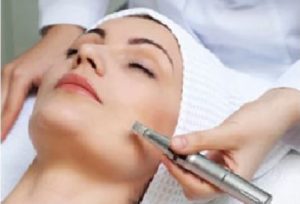 A woman lying down receiving microneedling